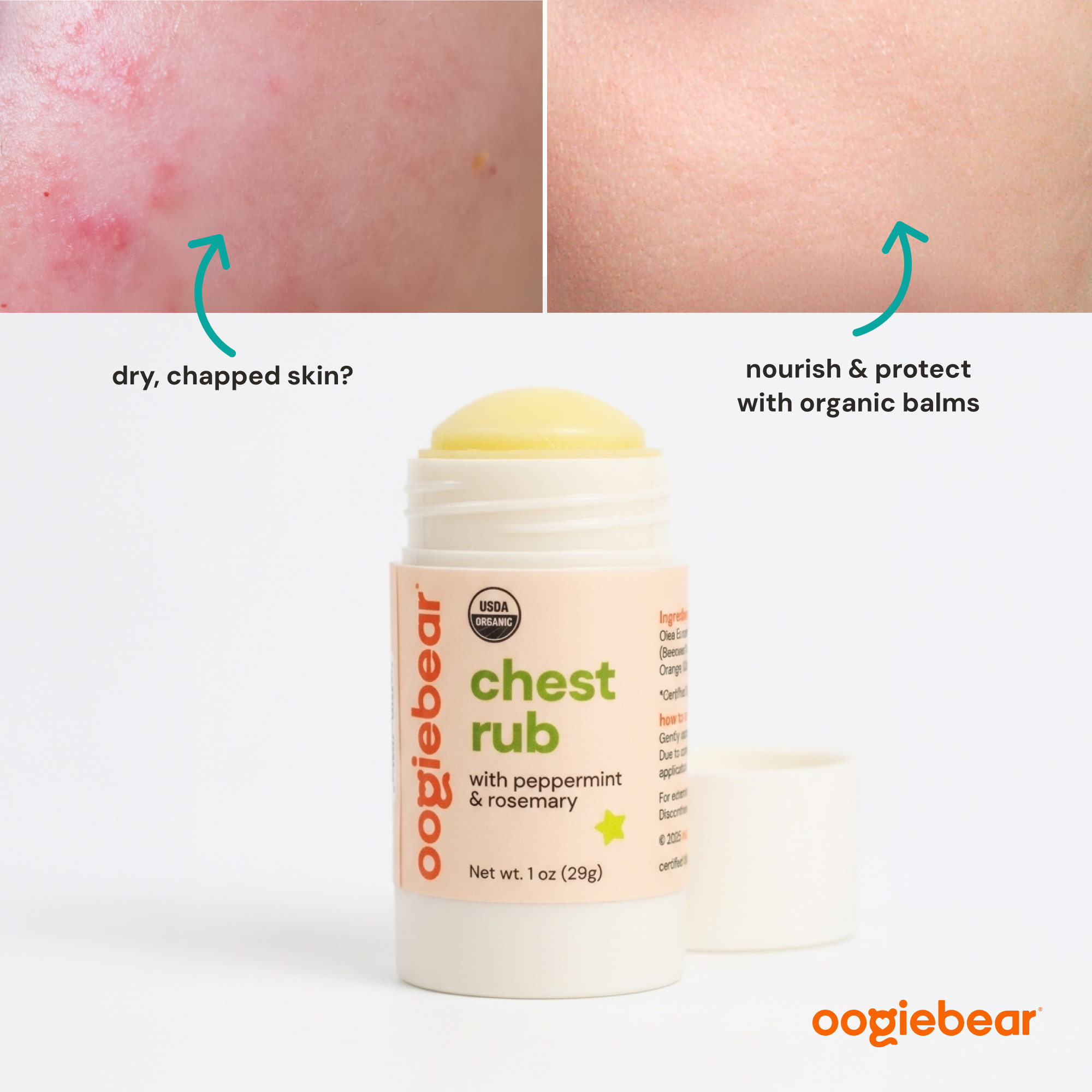 Oogiebear -  Chest Rub